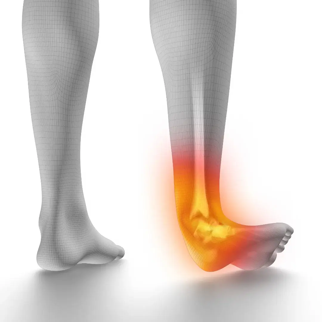 Chiropractic care for ankle sprain recovery