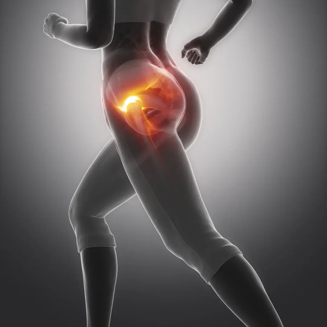 Chiropractic care for hip arthritis pain relief