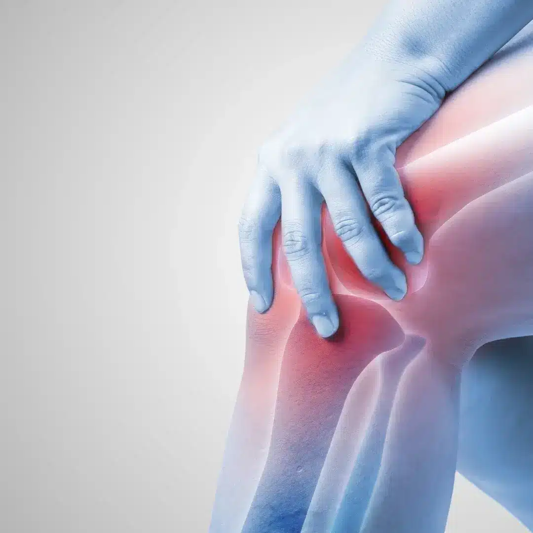 osgood-schlatter-disease